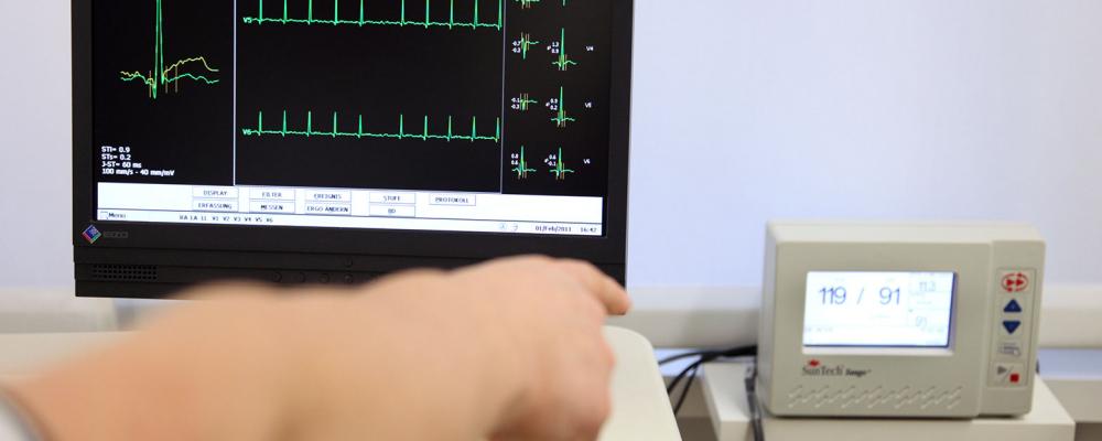 Stress EKG